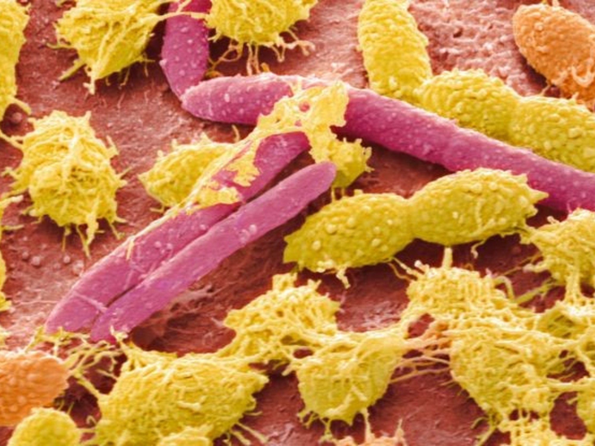 Microfotografía electrónica coloreada de bacterias y células de la mucosa oral humana